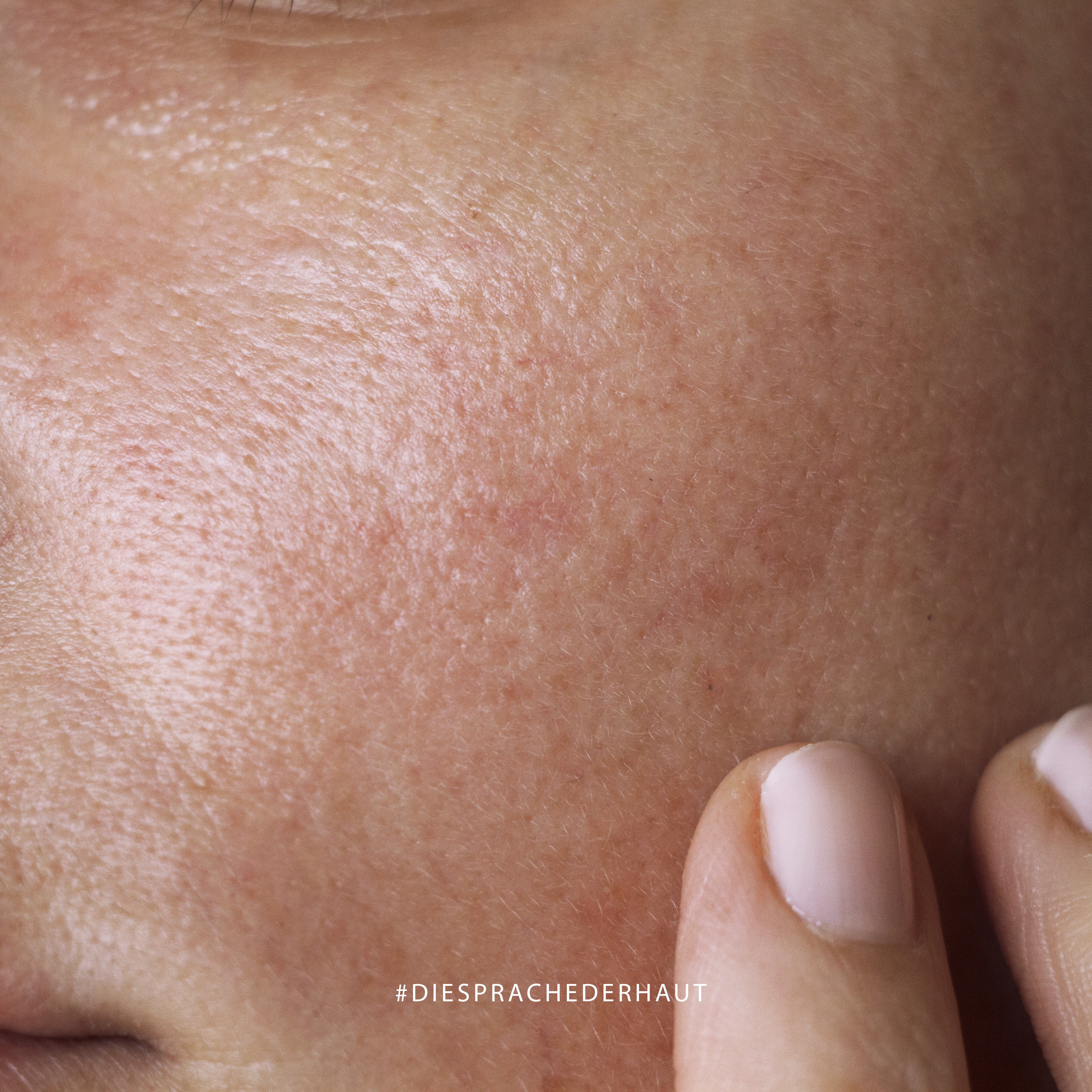 Rassoden Cream- pore dilaté et relâchement 50ml