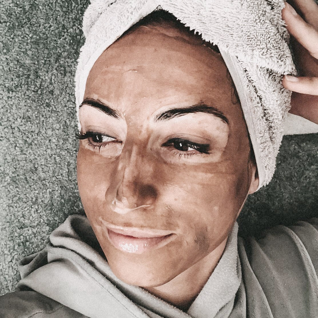 peeling ordinary